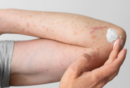 3 Kebiasaan Buruk yang Sering Dilakukan Pengendara Motor, Bikin Kulit Rusak