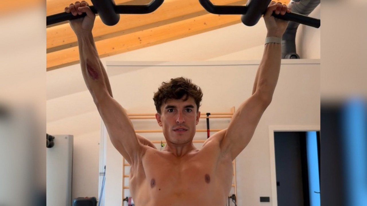 Marc Marquez Perlihatkan Bahu Kanan Usai Cedera Panjang dan Tujuh Kali Operasi, Begini Kondisinya
